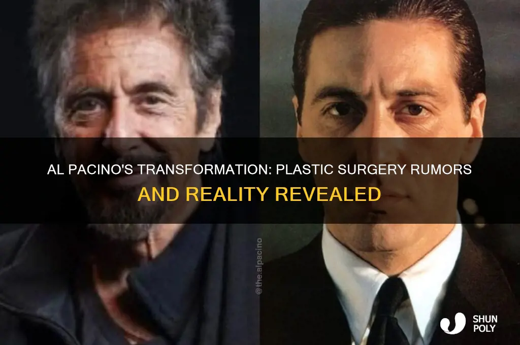 did al pacino get plastic surgery
