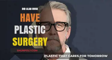 Alan Ruck's Transformation: Plastic Surgery Speculations and Truths Revealed