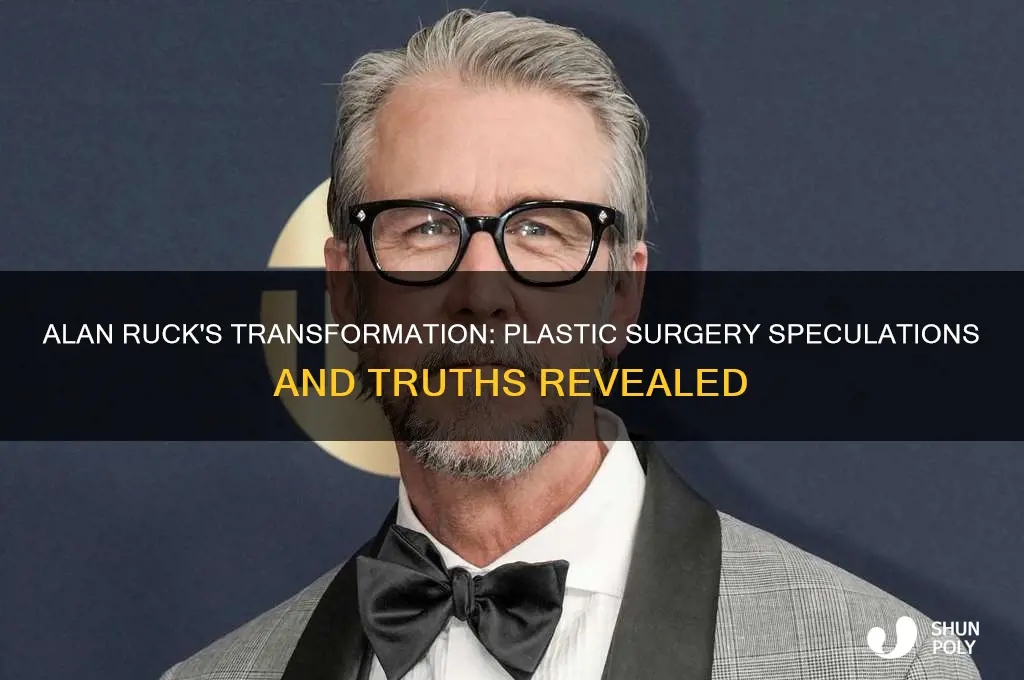 did alan ruck have plastic surgery