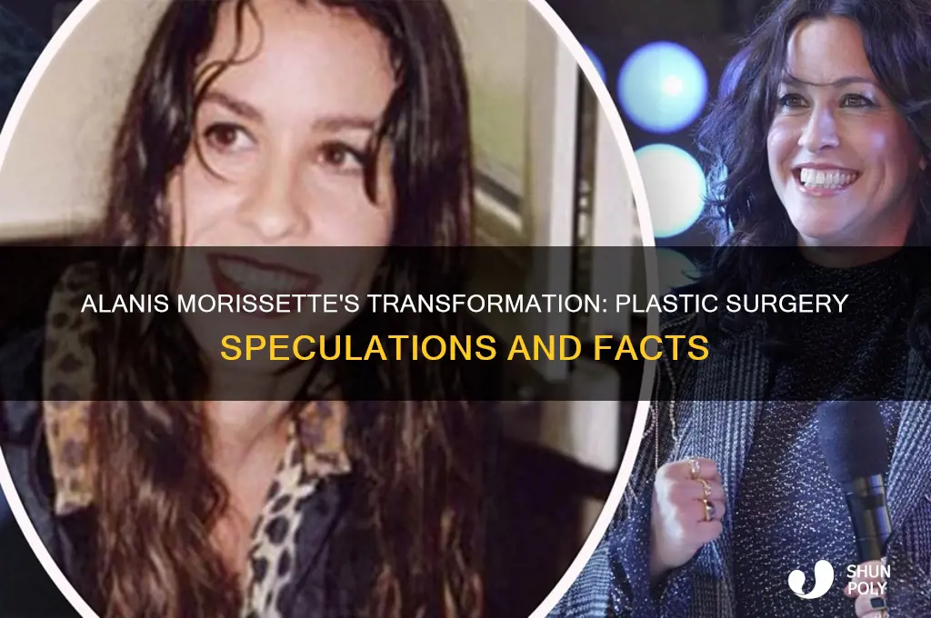 did alanis morissette have plastic surgery