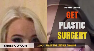 Did Alex Cooper Undergo Plastic Surgery? Unveiling the Truth