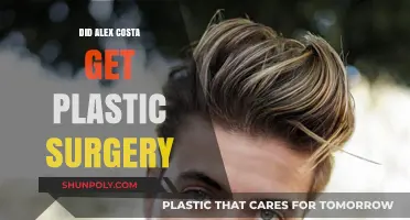 Did Alex Costa Undergo Plastic Surgery? Unveiling the Truth
