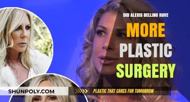 Alexis Bellino's Plastic Surgery: New Procedures or Natural Glow?