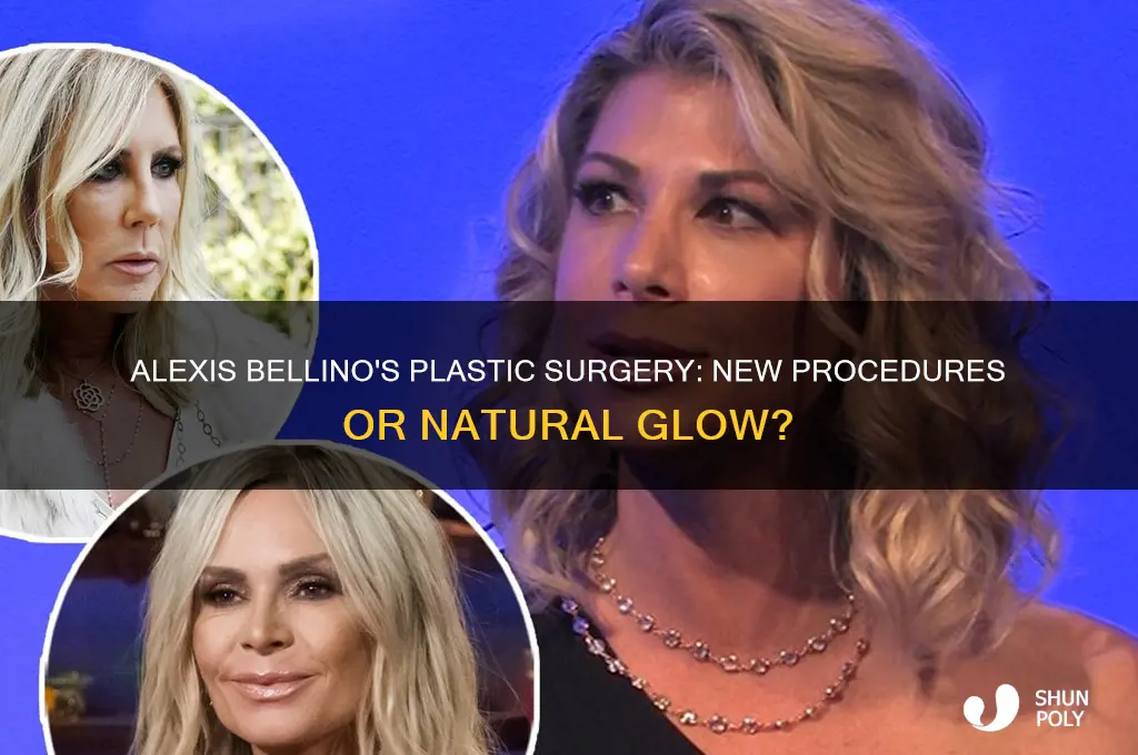did alexis bellino have more plastic surgery