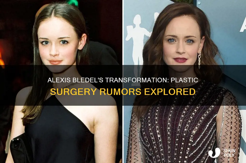 did alexis bledel get plastic surgery