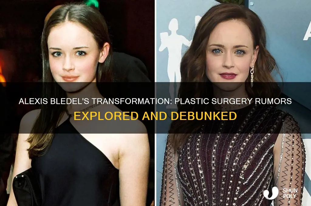 did alexis bleidel have plastic surgery