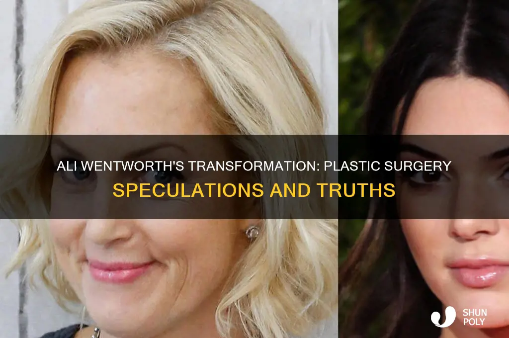 did ali wentworth have plastic surgery