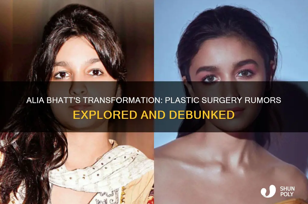 did alia bhatt get plastic surgery