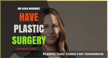 Alicia Menendez Plastic Surgery: Fact-Checking the Rumors and Speculations