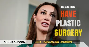 Alina Habba Plastic Surgery: Fact-Checking Rumors and Speculations