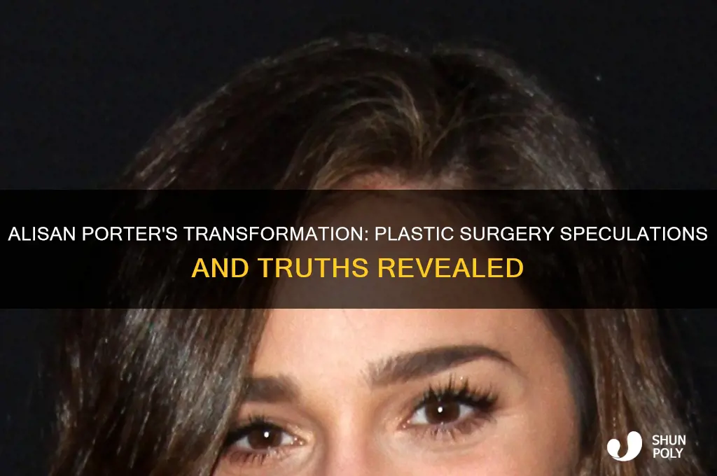 did alisan porter get plastic surgery