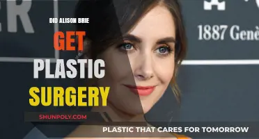 Alison Brie's Transformation: Plastic Surgery Rumors Explored and Debunked