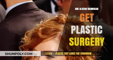 Alison Hannigan's Transformation: Plastic Surgery Rumors Explored