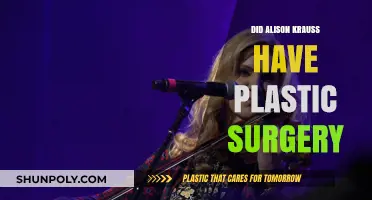 Alison Krauss Plastic Surgery: Fact-Checking the Rumors and Speculations