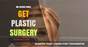 Alison Sudol Plastic Surgery: Fact-Checking the Transformation Rumors