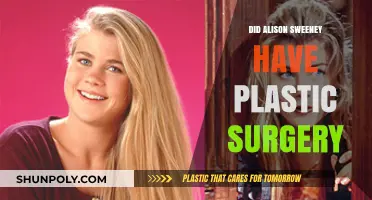 Alison Sweeney's Transformation: Plastic Surgery Rumors Explored and Debunked
