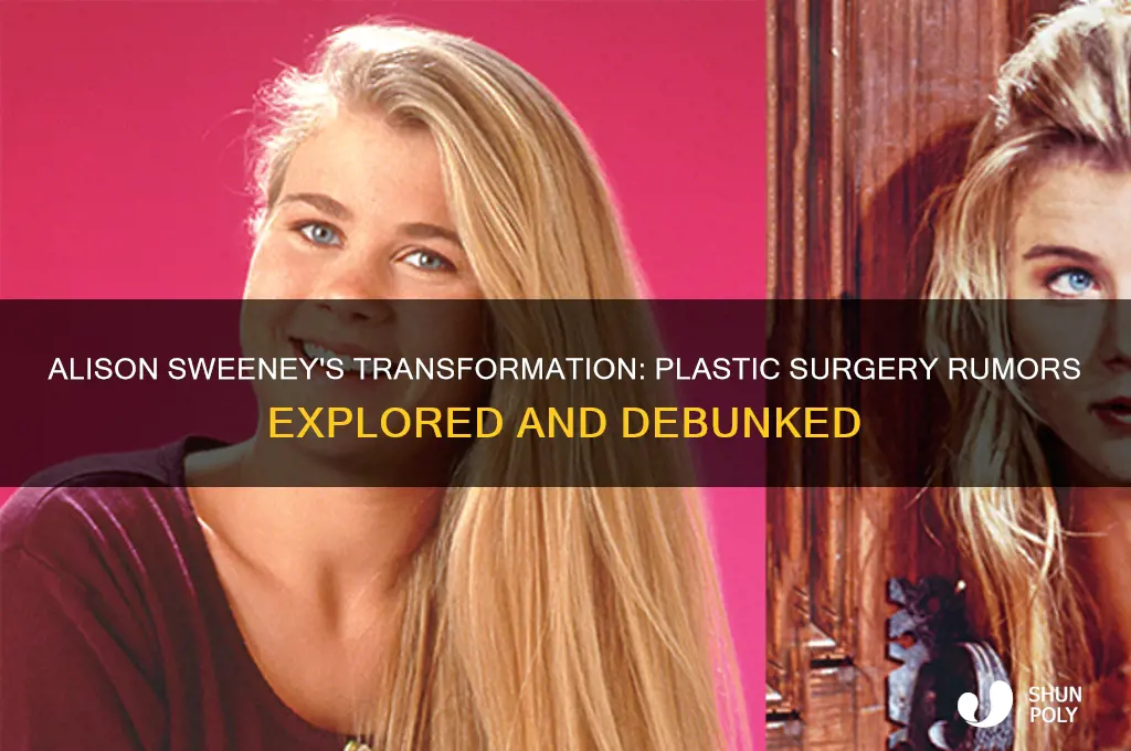 did alison sweeney have plastic surgery