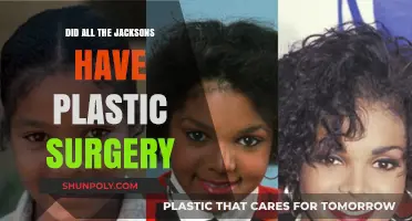 The Jackson Family's Transformation: Plastic Surgery Speculations and Truths