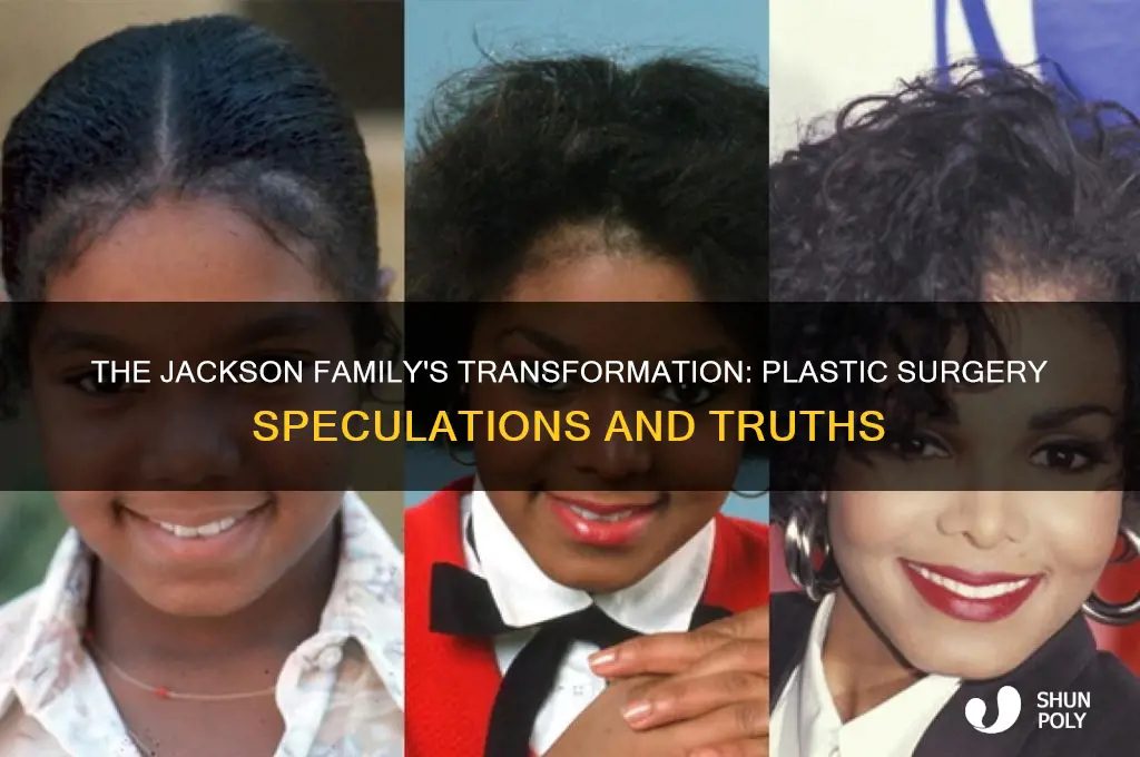 did all the jacksons have plastic surgery