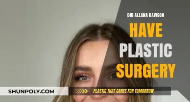Did Allana Davison Undergo Plastic Surgery? Unveiling the Truth