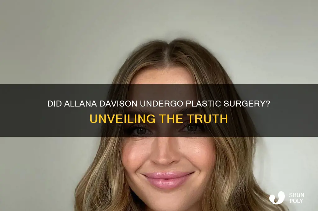 did allana davison have plastic surgery