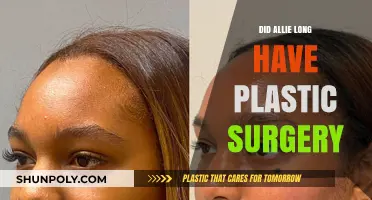 Allie Long's Transformation: Plastic Surgery Speculations and Facts Revealed