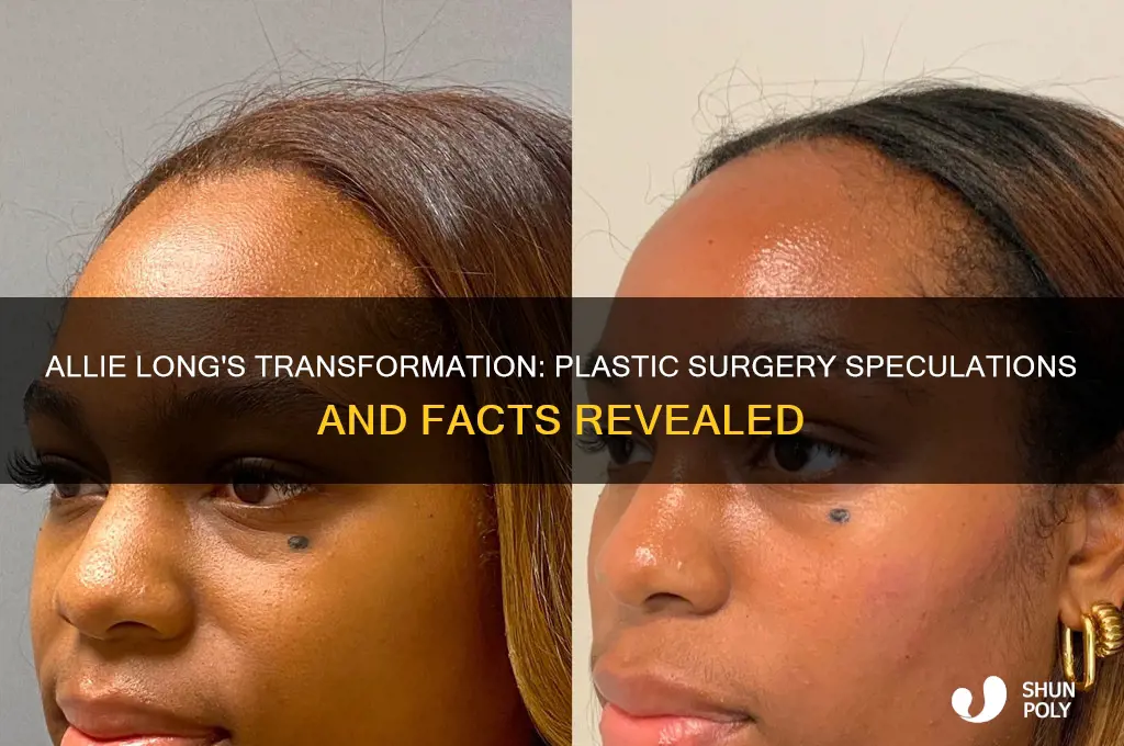 did allie long have plastic surgery
