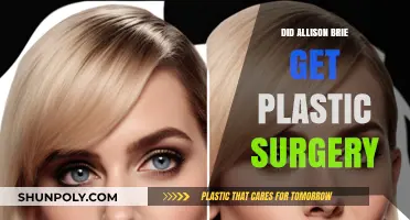 Allison Brie Plastic Surgery: Fact-Checking the Rumors and Speculations