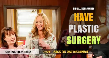 Allison Janney's Transformation: Plastic Surgery Rumors Explored