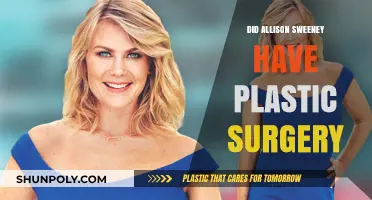 Allison Sweeney's Transformation: Plastic Surgery Rumors Explored and Debunked