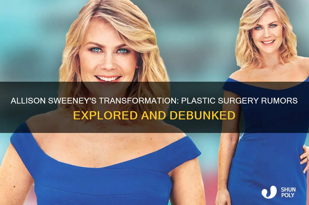 did allison sweeney have plastic surgery