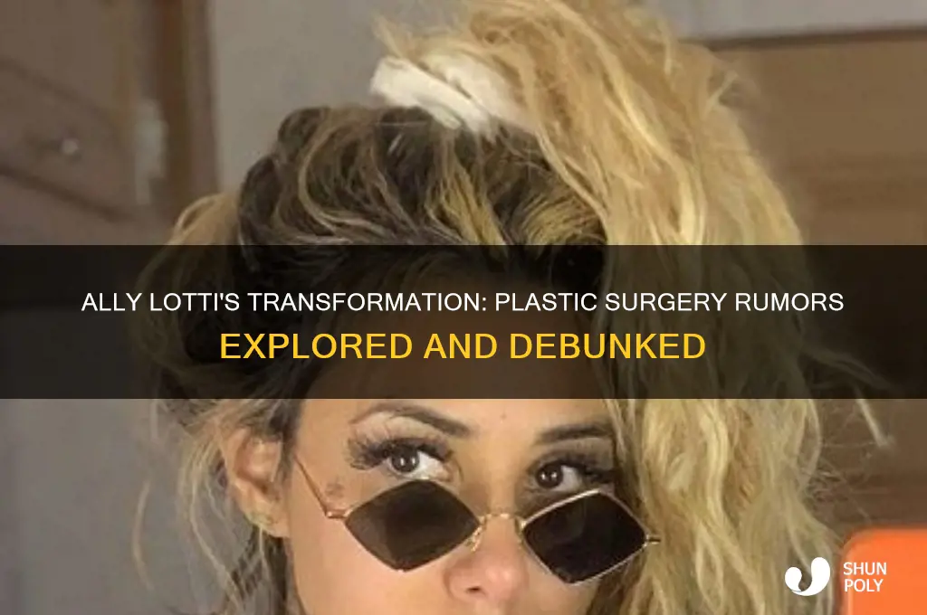 did ally lotti get plastic surgery