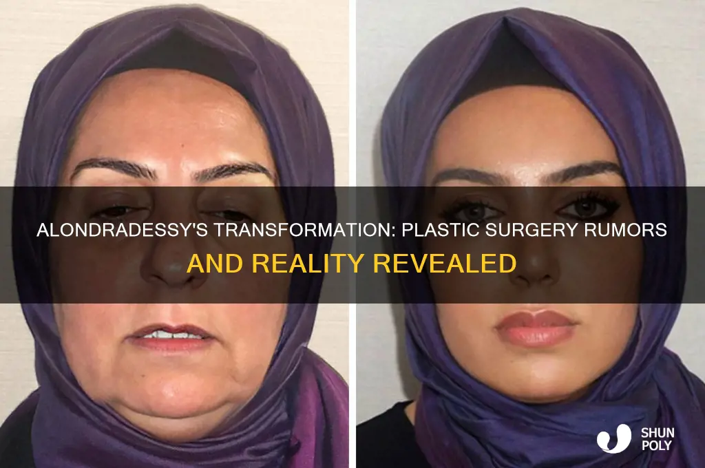 did alondradessy get plastic surgery