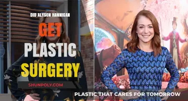 Alyson Hannigan's Transformation: Plastic Surgery Rumors Explored