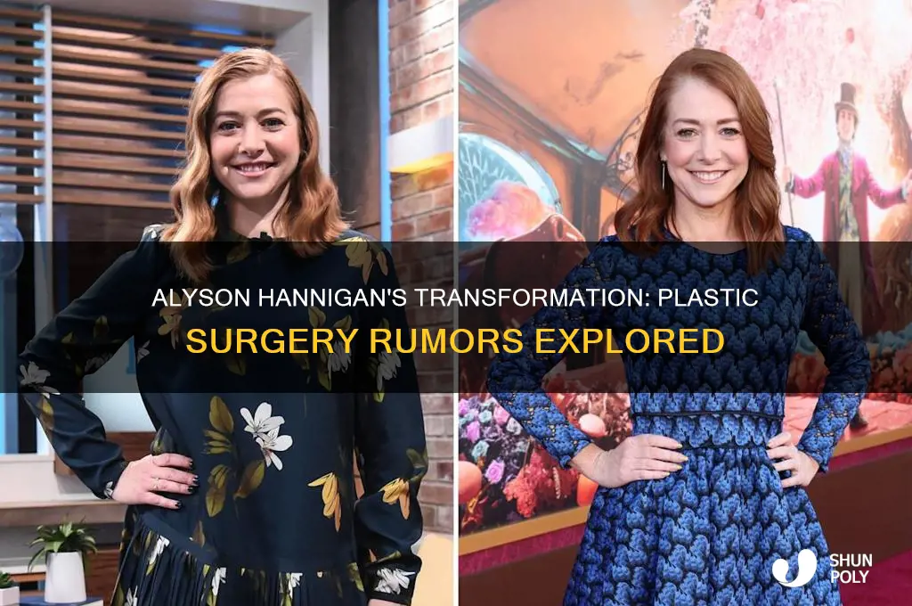 did alyson hannigan get plastic surgery