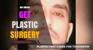 Did Amado Undergo Plastic Surgery? Unveiling the Truth Behind the Rumors
