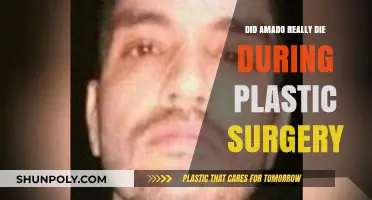 Did Amado's Plastic Surgery Lead to Tragic Death? Unveiling Truth