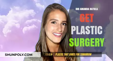 Amanda Batula Plastic Surgery: Fact-Checking the Transformation Rumors