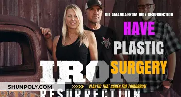 Amanda from Iron Resurrection: Plastic Surgery Speculations and Truths