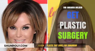 Amanda Holden's Transformation: Plastic Surgery Speculations and Truths