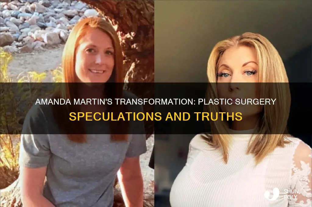 did amanda martin have plastic surgery