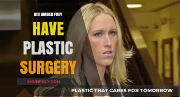 Amber Frey Plastic Surgery: Fact-Checking the Rumors and Speculations