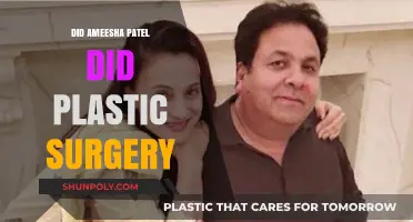 Did Amisha Patel Undergo Plastic Surgery? Unveiling the Truth