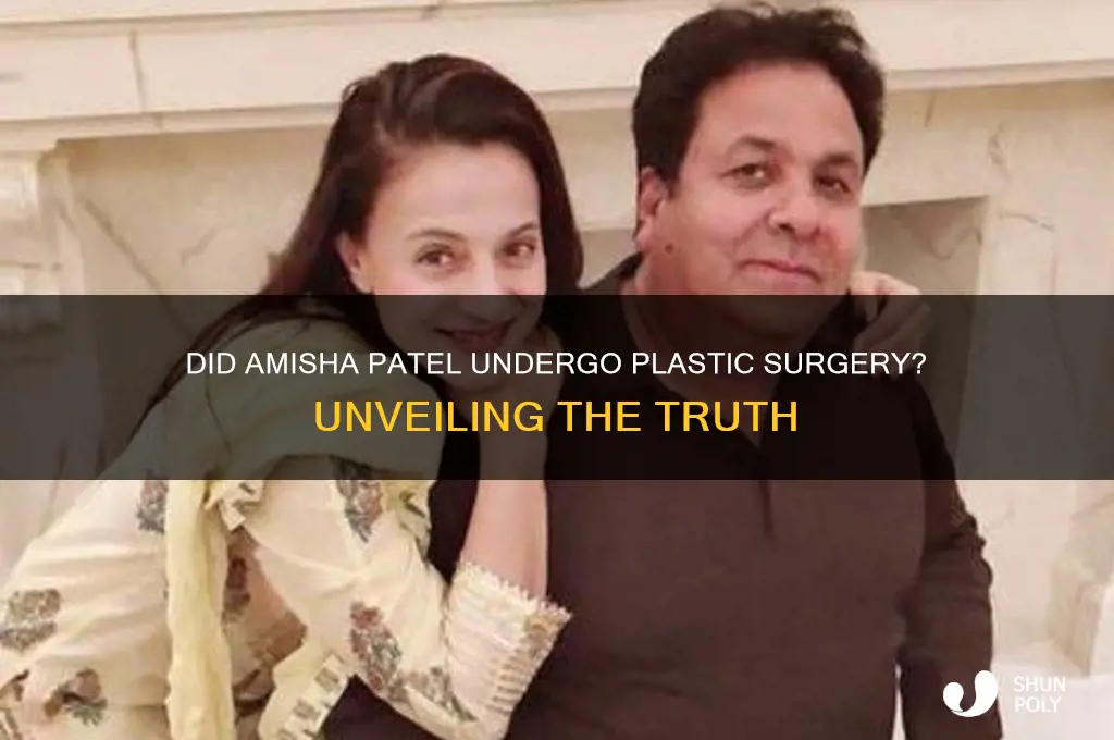 did ameesha patel did plastic surgery