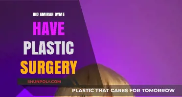 Amirah Dyme's Transformation: Plastic Surgery Rumors Explored