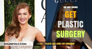 Amy Adams Plastic Surgery: Fact-Checking the Rumors and Speculations