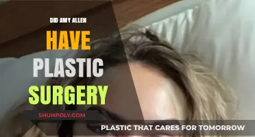 Amy Allen's Transformation: Plastic Surgery Speculations and Truths Revealed