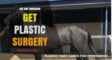 Amy Anderson's Transformation: Plastic Surgery Rumors Explored and Debunked