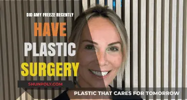Amy Freeze Plastic Surgery: Recent Speculations and Transformation Truths