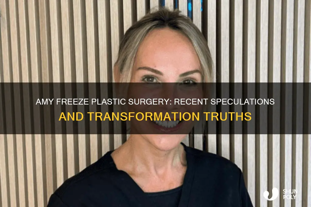 did amy freeze recently have plastic surgery